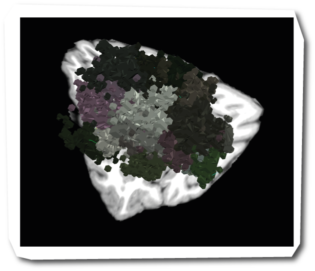 Figure 1. Left DLPFC parcellated using the Glasser atlas.