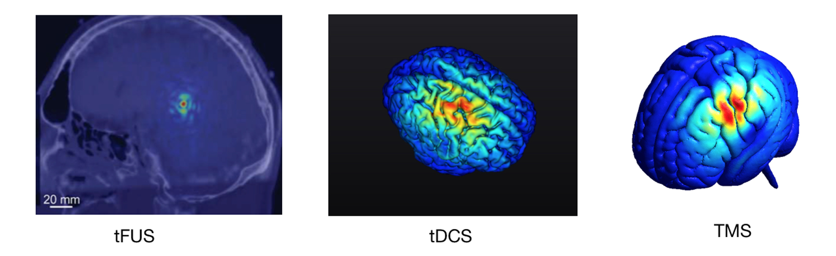 tFUS Focality