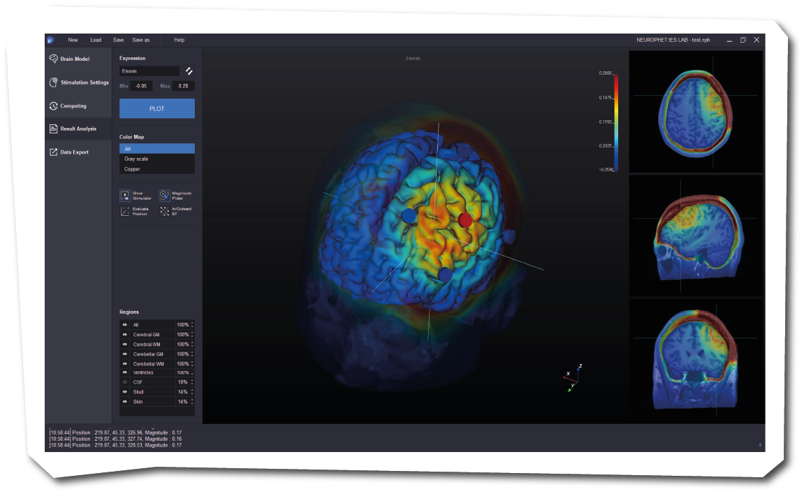 Neurophet tES Lab Graphical User Interface for Current Flow Modelling