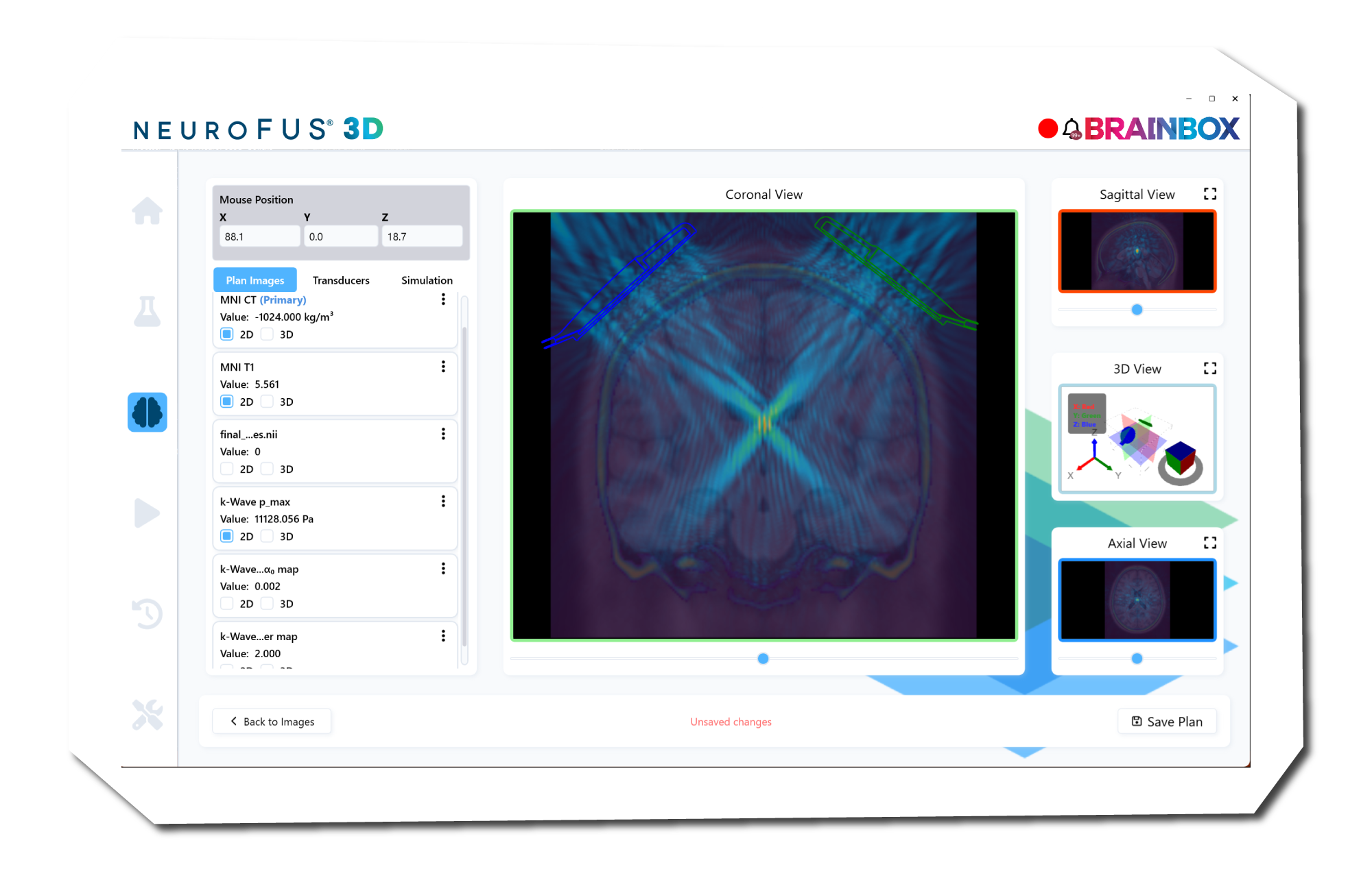 neurofus_gui