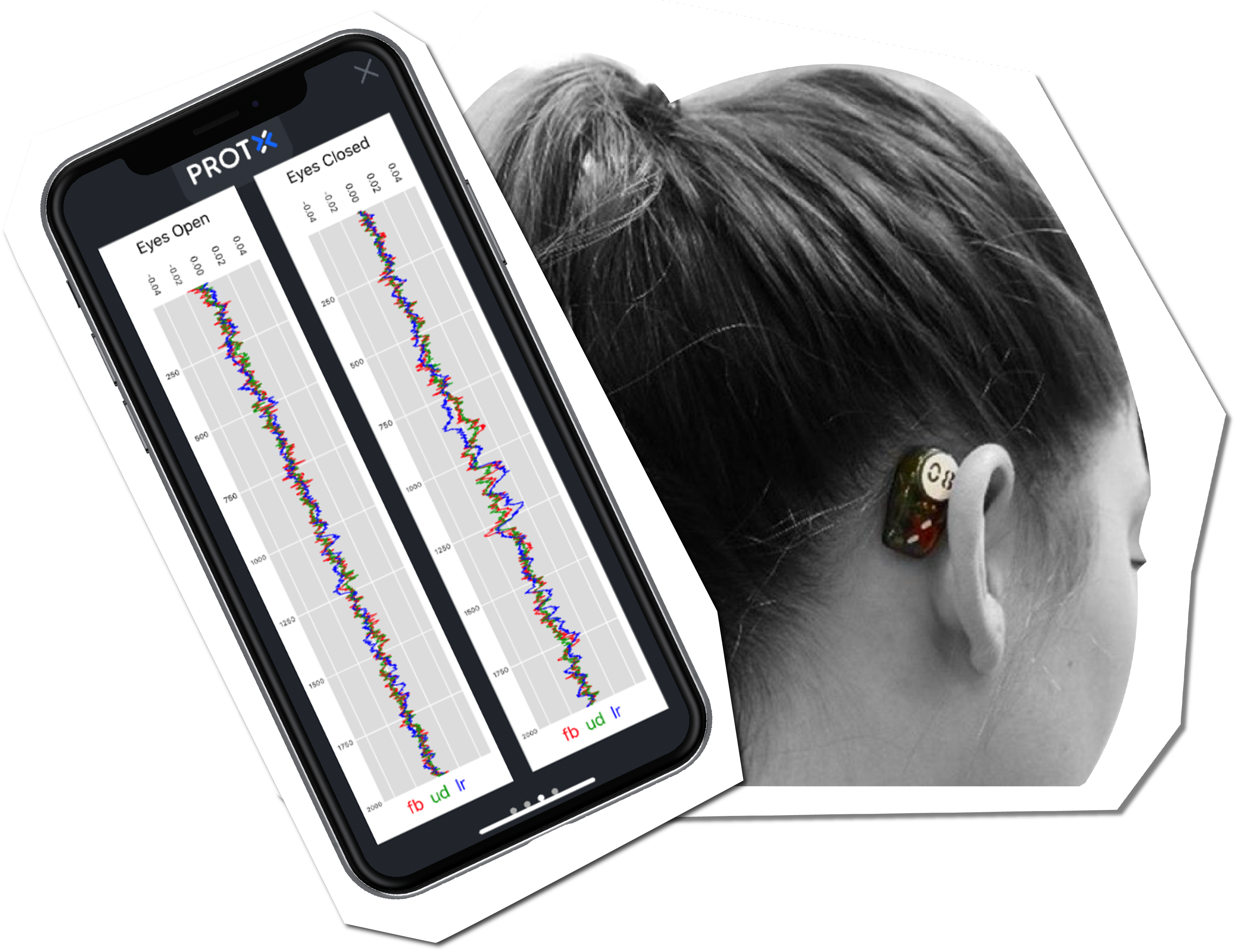 PROTXX Postural Sway Analysis