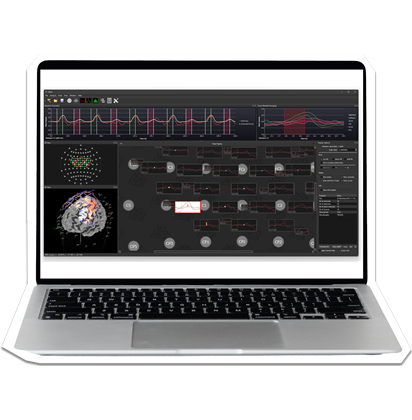 Satori fNIRS Software
