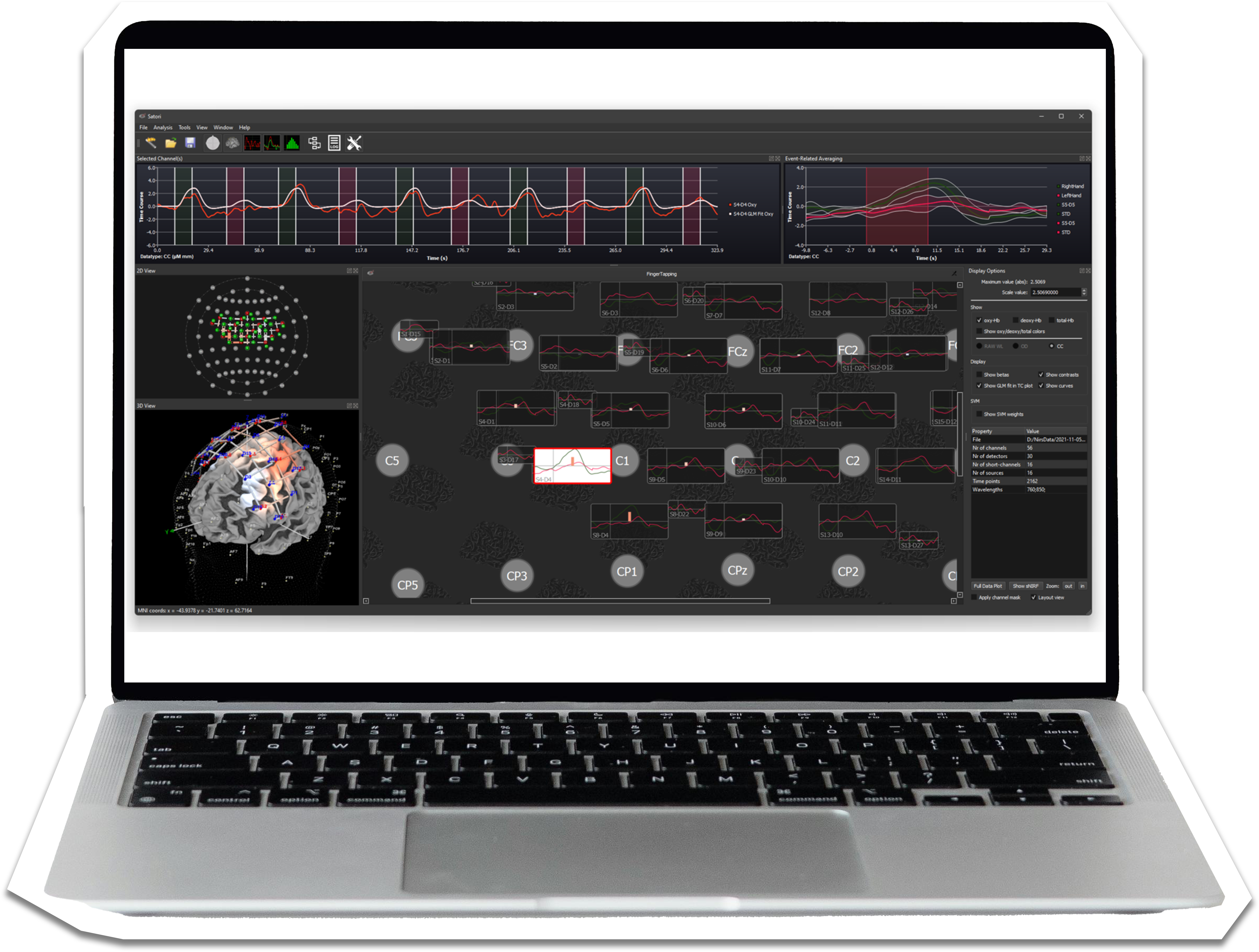 Satori fNIRS Software