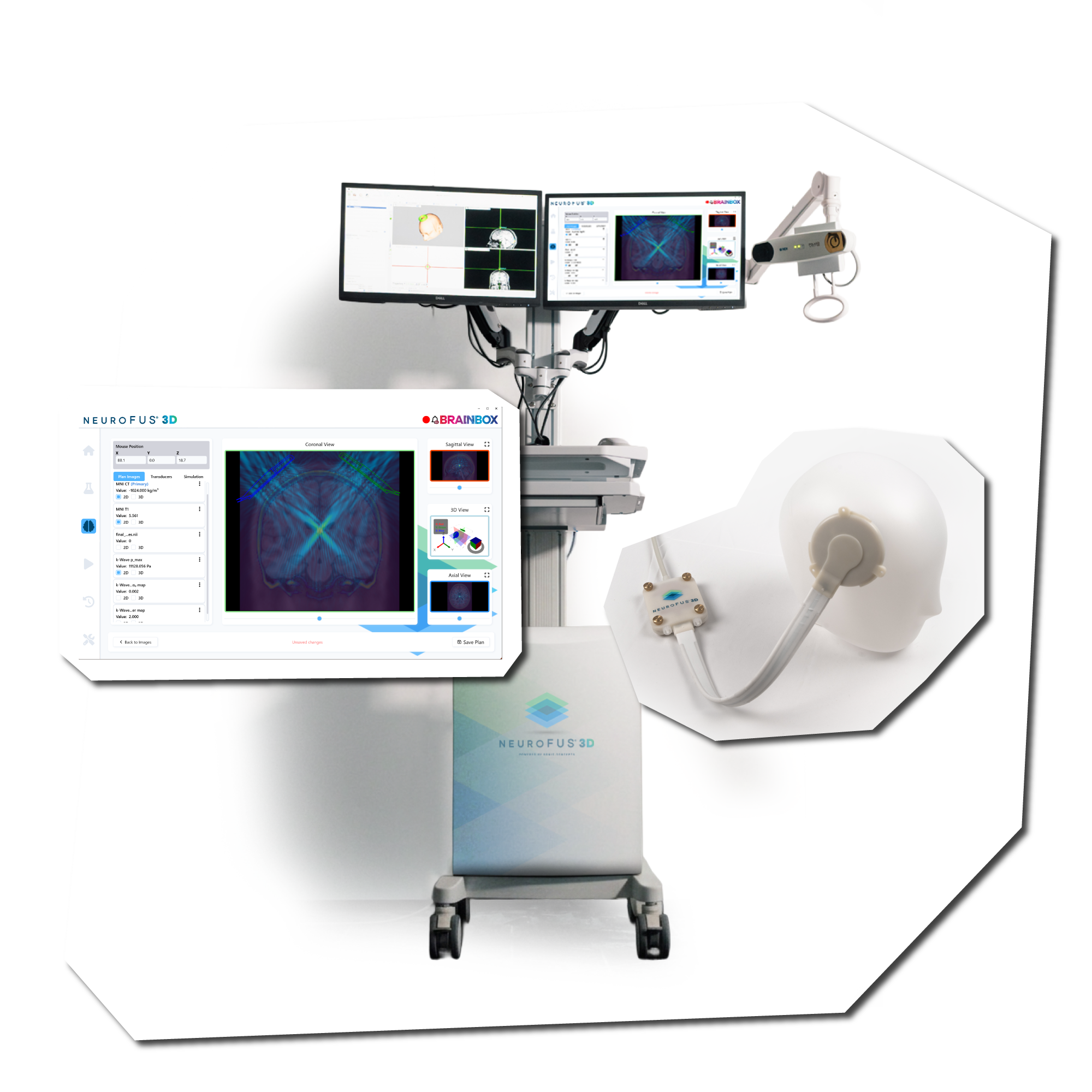 NeuroFUS 3D